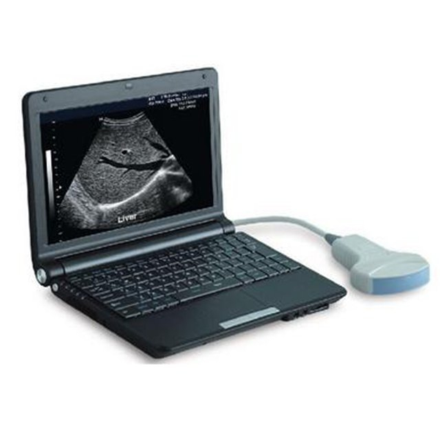 PT3000D1 Scanner ad ultrasuoni portatile in bianco e nero