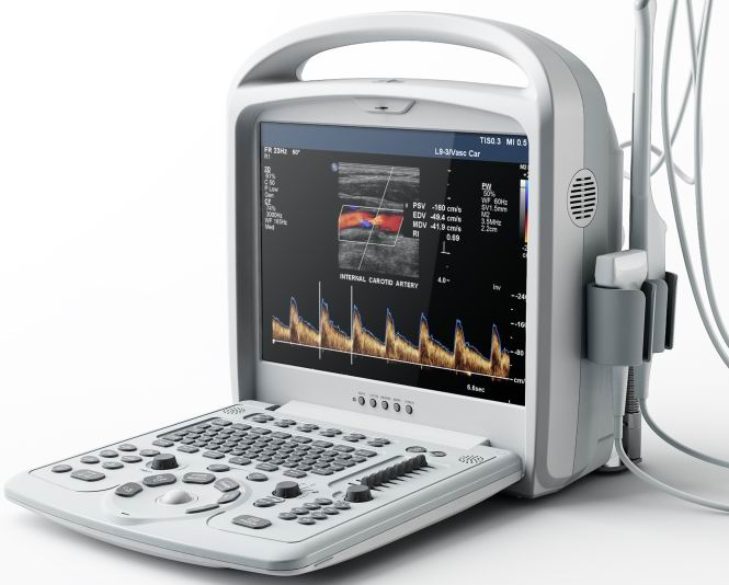 PT9600 Sistema diagnostico a ultrasuoni color doppler portatile 2D